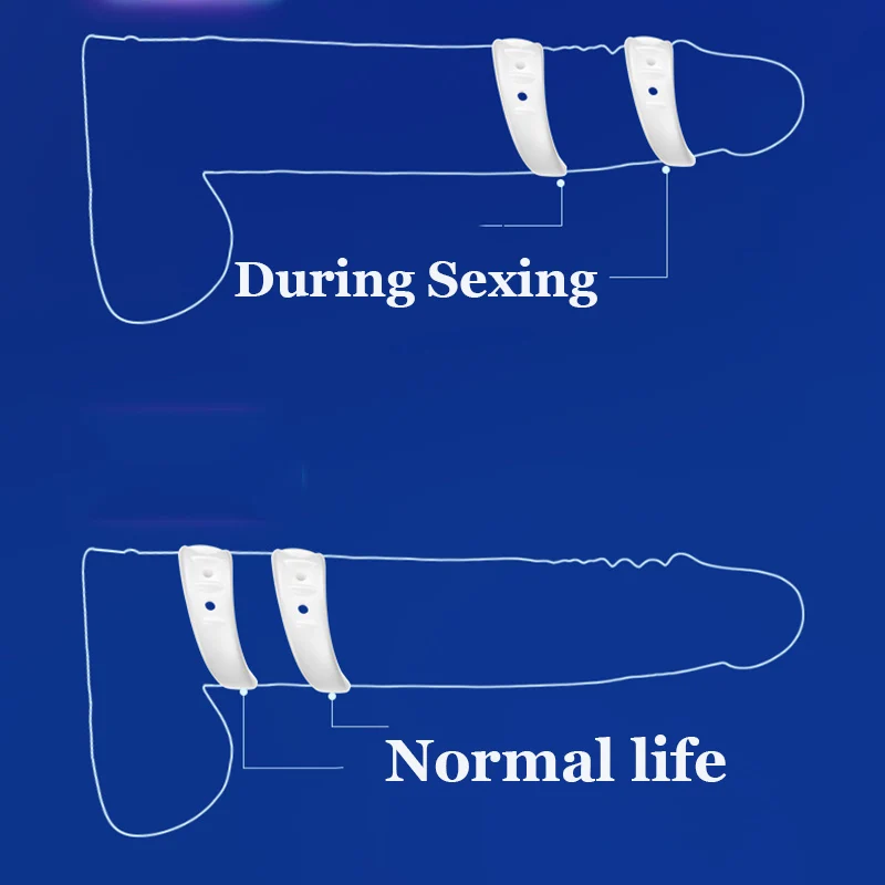 2PCS/Set Male Foreskin Corrector Ring Penis Rings Delay Ejaculation Daily/Night Cock Ring Chastity Cage Sex Toys for Men 2PCS/Set Male Foreskin Corrector Ring Penis Rings Delay Ejaculation Daily/Night Cock Ring Chastity Cage Sex Toys for Men