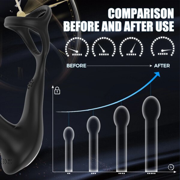 Bead Thrusting Prostate Massager For Men Remote Control Anal Vibrator Butt Plug With Vibration Gay Sex Toys Sex Toy for Couples