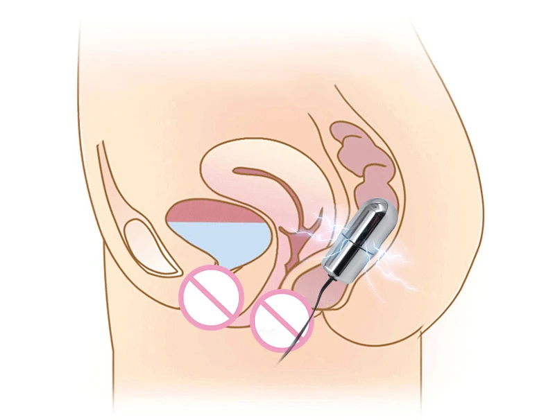 Electric Stimulation Massage Sex Toys Electro Shock Pulse Anal Butt Plug Penis Cage/Plug/Ring Nipple Clamp Labia Clip SM Roller