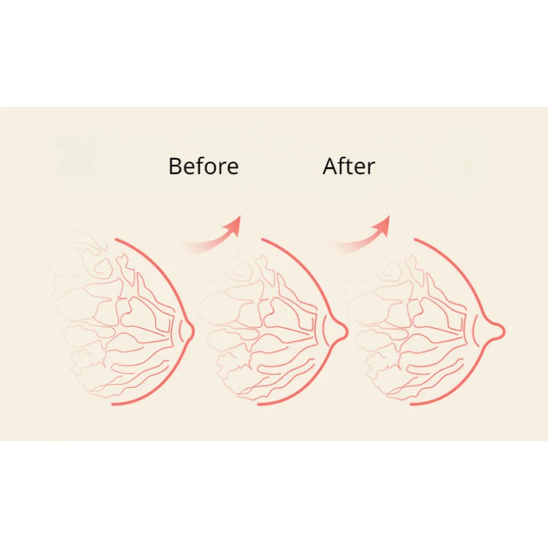 Silicone Nipple Clamps Retraction Pump Sucker Teat Massager Corrector Nipple Sucker Breast Stimulator Sex Toys for Woman Man