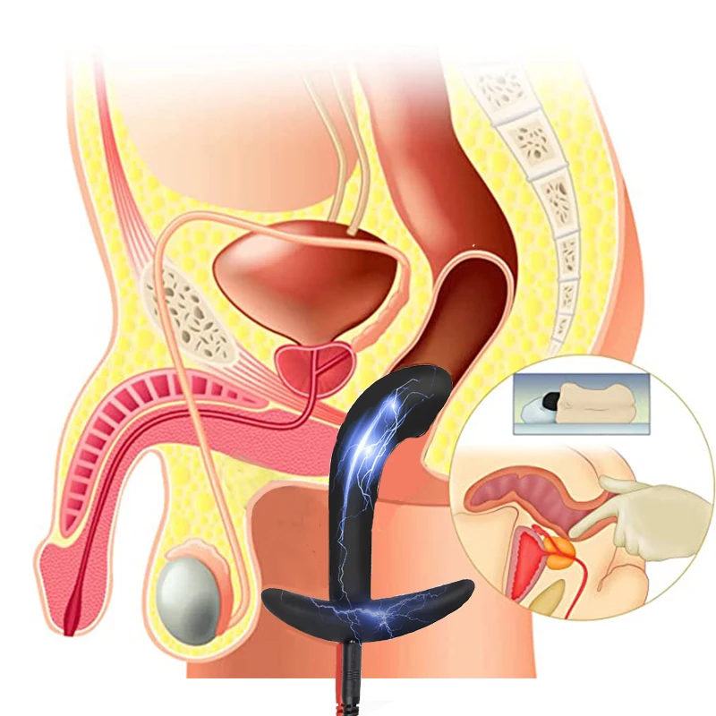 Electric Shocker Anal Butt Plug,Estim E stim Urethral Dilator,BDSM Electro Shock Penis Plug,Sex Toys Men,Electrostimulation Electric Shocker Anal Butt Plug,Estim E stim Urethral Dilator,BDSM Electro Shock Penis Plug,Sex Toys Men,Electrostimulation
