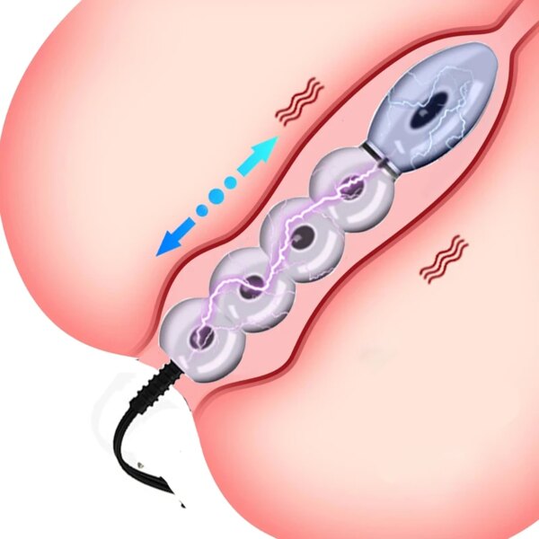 Electrostimulator for Men,Electric Shock Sex Anal Butt Plug Stimulation,Electro BDSM Cock Penis Ring,e stim Estim Electrosex