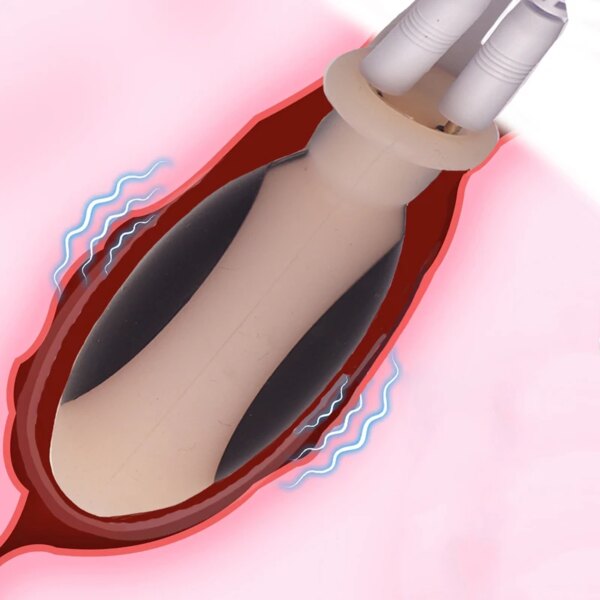 E stim Electrostimulation Estim Anal Butt Plug Dildo,,Bdsm Electro Shock Nipple Sucker,Electric Sex,E-stim,Electrostimulator