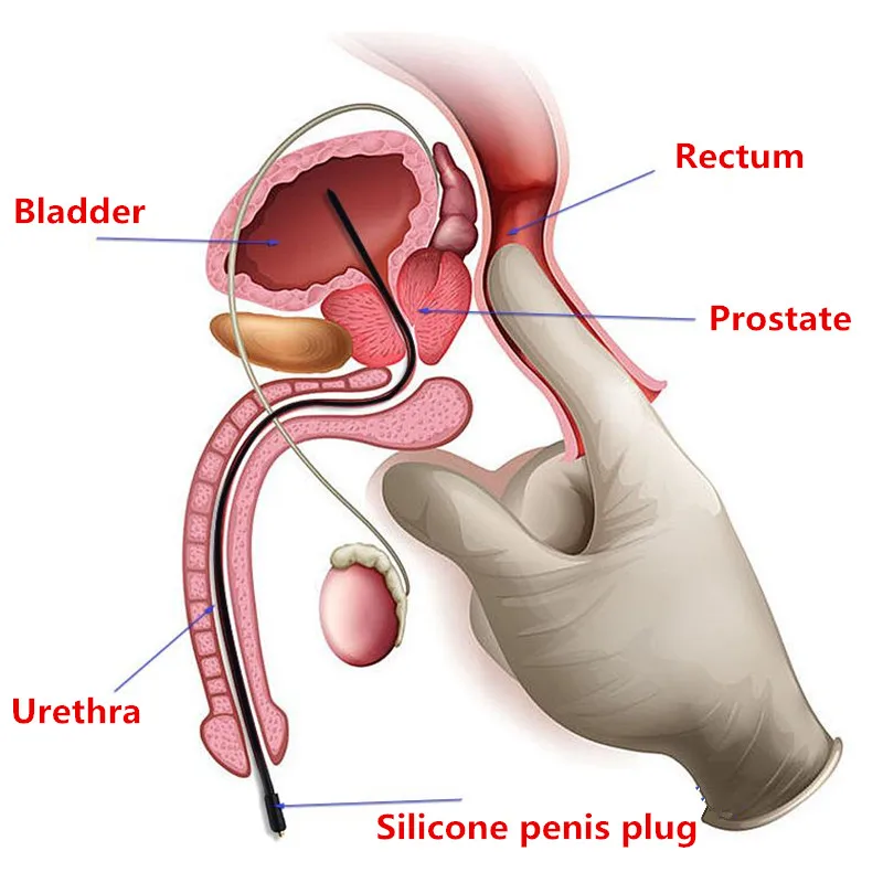 Taser Electro Shock Sex Accessorry E-stim Penis/Glans/Anal/Clit/Vagina/Labia/Nipple Electric Masturbation Products For Women Men