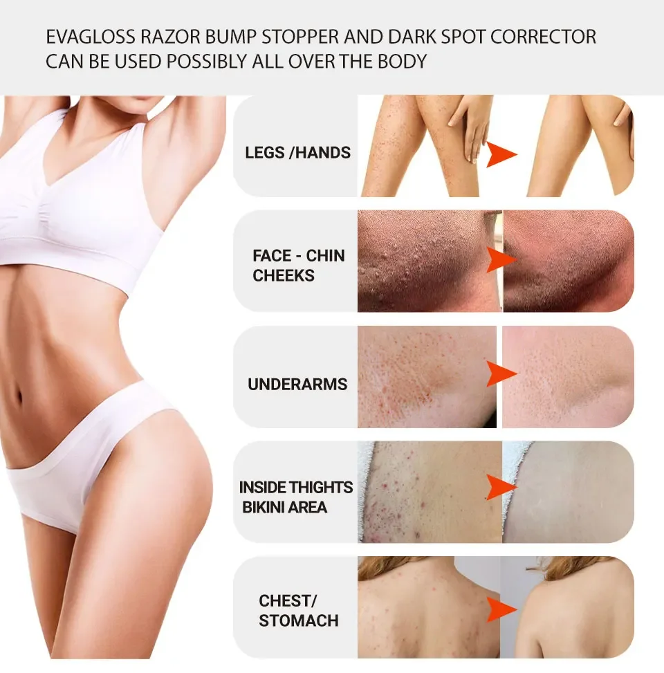 Original Hair Removal Spray For Women 2 in 1 Intimate/Private Hair Removal Spray for Women Pubic Bikini Area Painless Depilatory