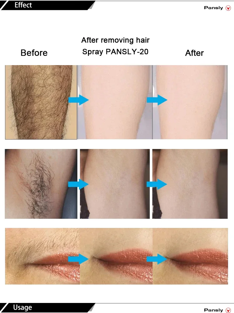 Original Hair Removal Spray For Women 2 in 1 Intimate/Private Hair Removal Spray for Women Pubic Bikini Area Painless Depilatory