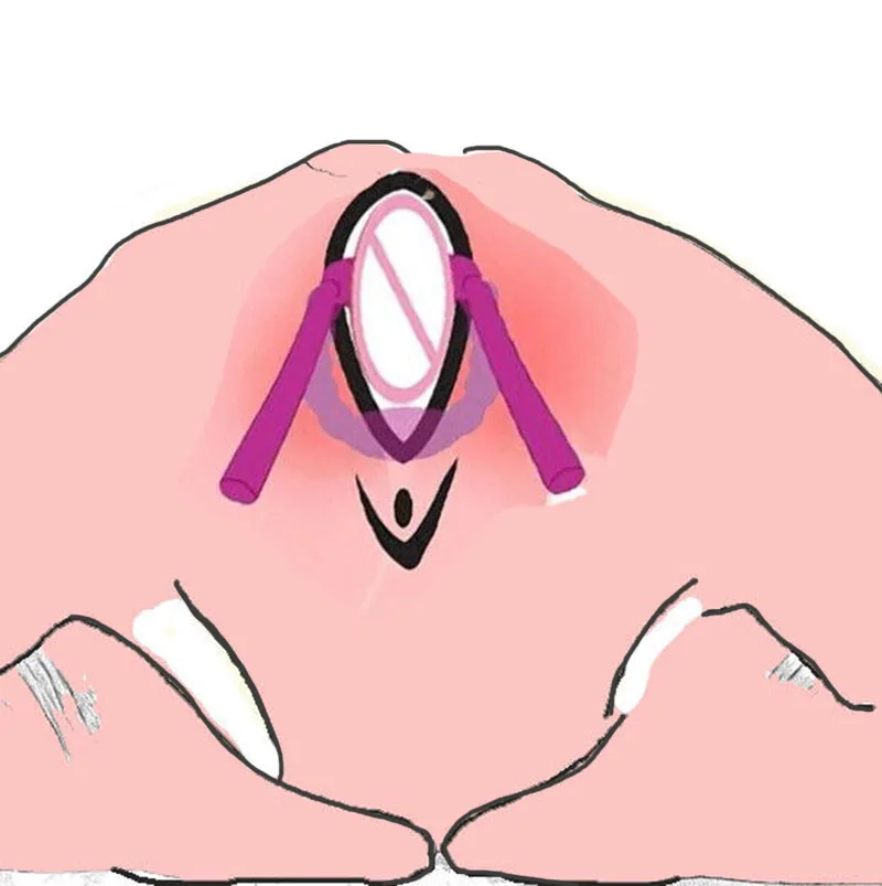 BDSM Labia Clamps Toy,Pussy Clitoris G-spot Speculum Spreader Lips of Vagina,Mouth Ring Gag,Adult Sex Whip Paddle,Bondage Gear