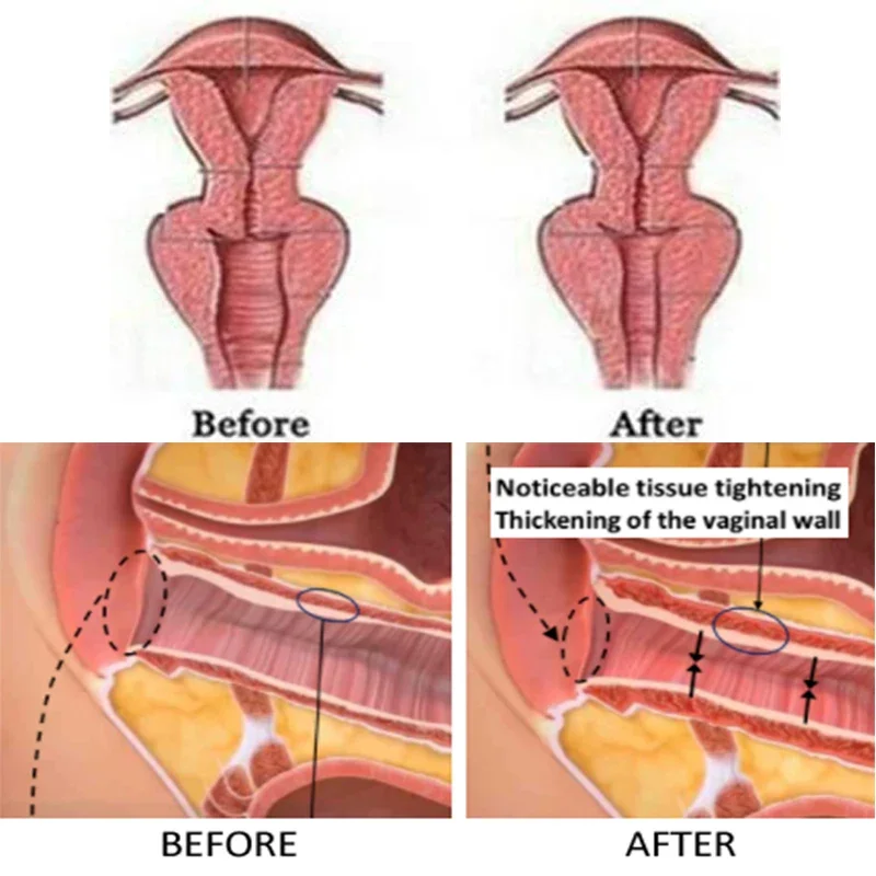 10ml Japanese Squirt Master Orgasm Enhancer Woman Excited Oil Increase Stimulant Orgasmic Gel for Women Aphrodisiac Massage Oil