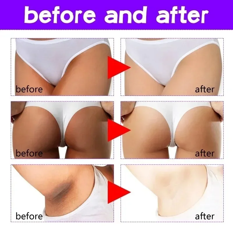 Face Body Brightening Cream Thigh Underarm Inner Melanin Lightening Lotion Gentle Nourishing Improve Dull Brighten Skin Care Face Body Brightening Cream Thigh Underarm Inner Melanin Lightening Lotion Gentle Nourishing Improve Dull Brighten Skin Care