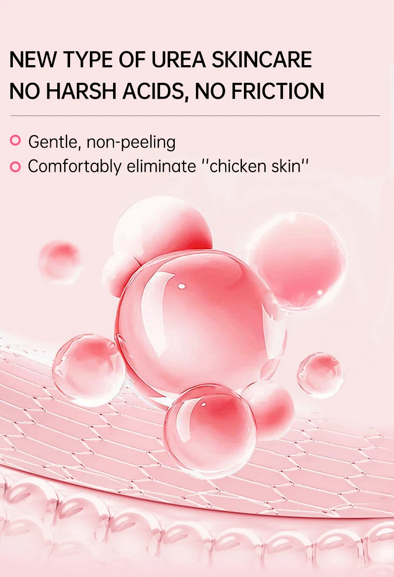 Body Cream Chicken Skin Removal Treatment Keratosis Pilaris Lotion Rough Bumpy Pore Spots Care Moisturizer Whitening Creams 60g Body Cream Chicken Skin Removal Treatment Keratosis Pilaris Lotion Rough Bumpy Pore Spots Care Moisturizer Whitening Creams 60g