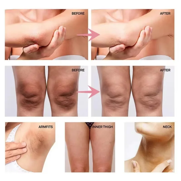 Inner Thigh Brighten Cream Bleaching Armpits Elbows Knees Moisturizing Brighten Body Lotion Cream Lightening Melanin Skin Cream