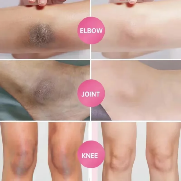 Inner Thigh Brighten Cream Bleaching Armpits Elbows Knees Moisturizing Brighten Body Lotion Cream Lightening Melanin Skin Cream