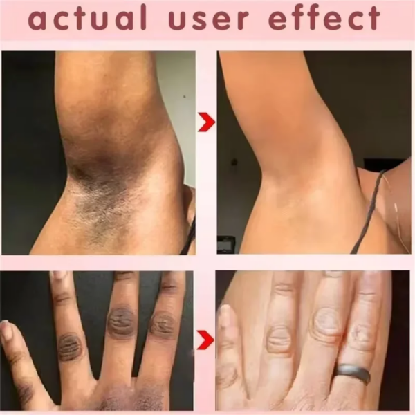 Inner Thigh Brighten Cream Bleaching Armpits Elbows Knees Moisturizing Brighten Body Lotion Cream Lightening Melanin Skin Cream