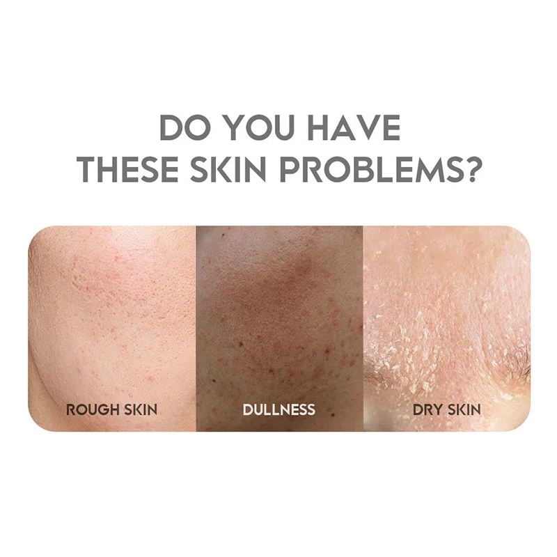 Inner Thigh Brighten Cream Bleaching Armpits Elbows Knees Moisturizing Brighten Body Lotion Cream Lightening Melanin Skin Cream