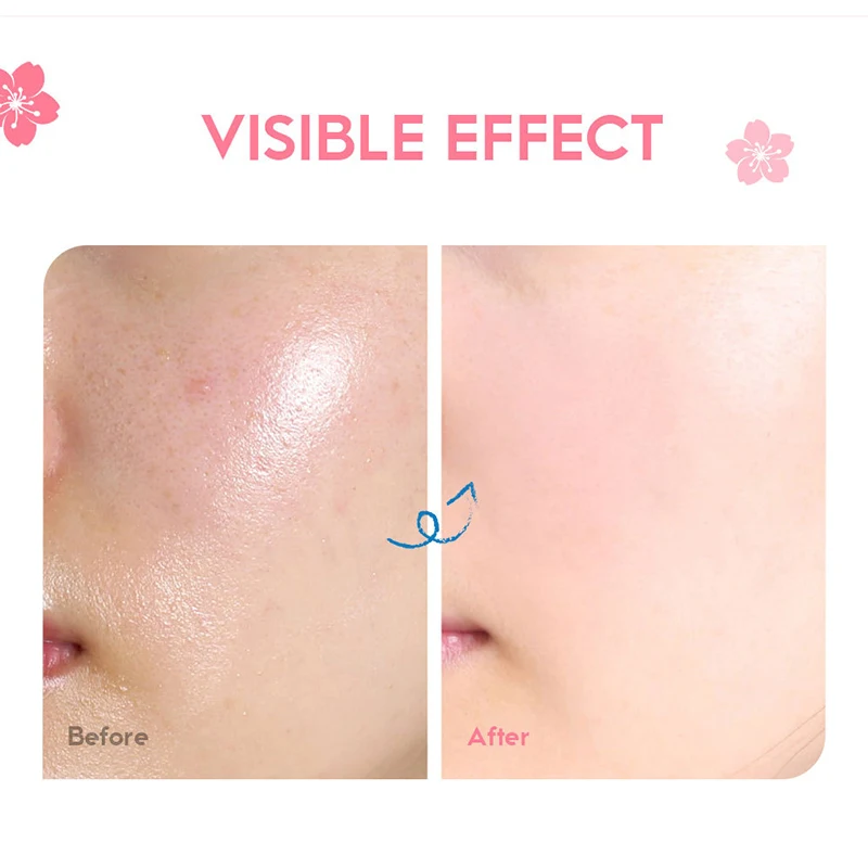 Inner Thigh Brighten Cream Bleaching Armpits Elbows Knees Moisturizing Brighten Body Lotion Cream Lightening Melanin Skin Cream