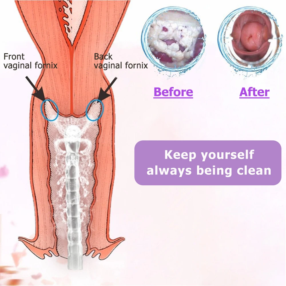 1PCS 600ML Rectal Syringe Clean Stream Anal Douche Enema Colon Cleaner Kit For Women Vaginal Clearner Anal Douche Enema Tool 1PCS 600ML Rectal Syringe Clean Stream Anal Douche Enema Colon Cleaner Kit For Women Vaginal Clearner Anal Douche Enema Tool