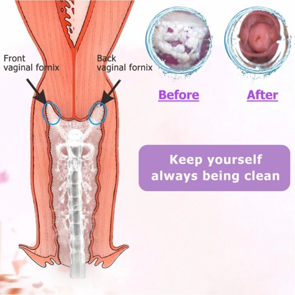 1PCS 600ML Rectal Syringe Clean Stream Anal Douche Enema Colon Cleaner Kit For Women Vaginal Clearner Anal Douche Enema Tool